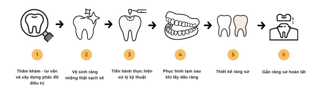 quy-trinh-boc-rang-su-tai-chi