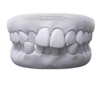 Modern Steps Project Management Process Infographic Graph 1 4 e1702436494439