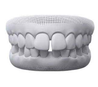 Modern Steps Project Management Process Infographic Graph 1 5 e1702436524419