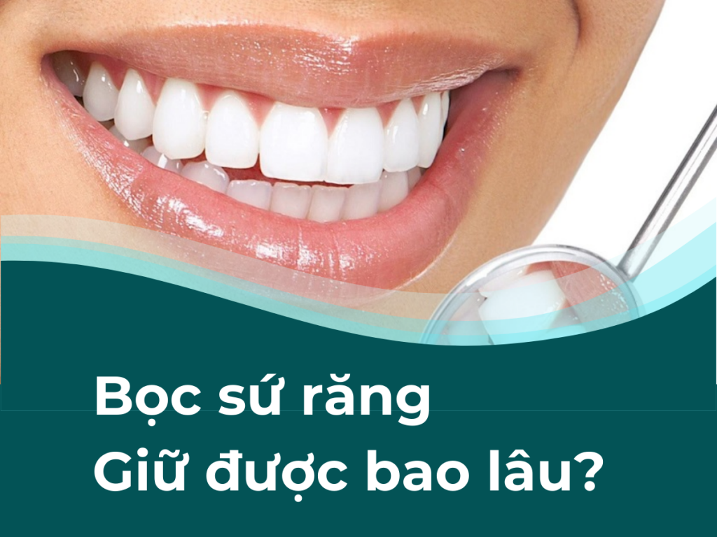Bọc sứ răng giữ được bao lâu? Biện pháp kéo dài tuổi thọ răng bọc sứ là gì? 42 Boc su rang Giu duoc bao lau 1