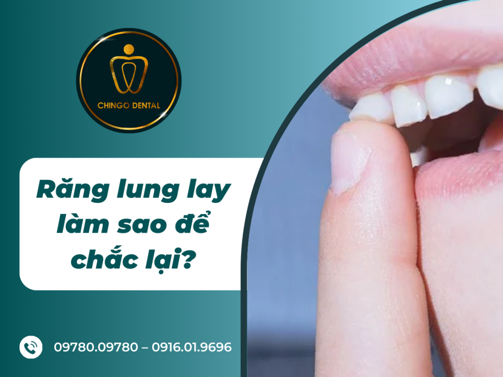 Răng lung lay làm sao để chắc lại? Cách khắc phục tình trạng răng lung lay 25 1