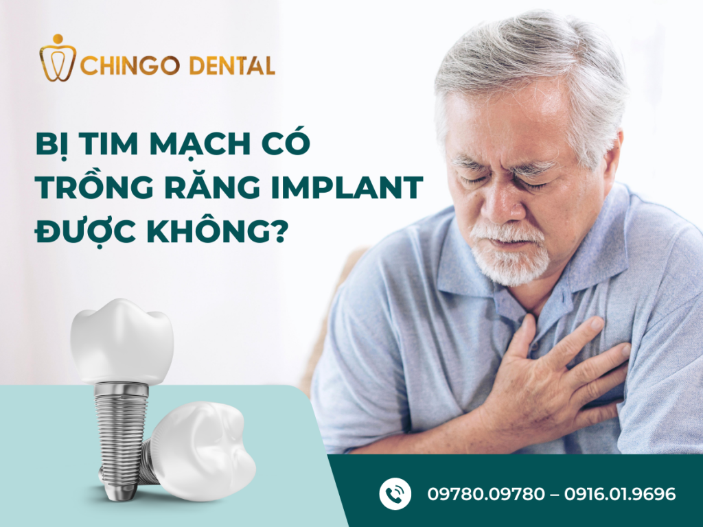 Bị TIM MẠCH CÓ TRỒNG RĂNG IMPLANT ĐƯỢC KHÔNG? 32 Bi tim mach co trong rang implant duoc khong