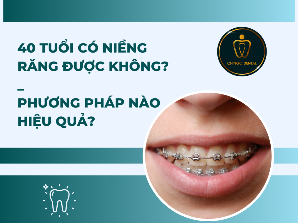 40 tuổi có niềng răng được không? Phương pháp nào hiệu quả? 55 40 tuoi co nieng rang duoc khong Phuong phap nao hieu qua