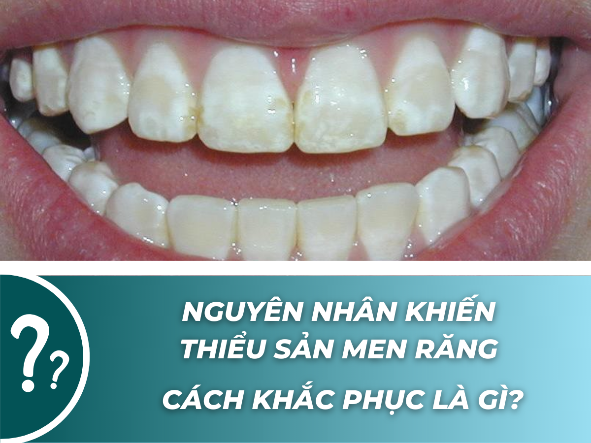 NGUYÊN NHÂN KHIẾN THIỂU SẢN MEN RĂNG CÁCH KHẮC PHỤC LÀ GÌ