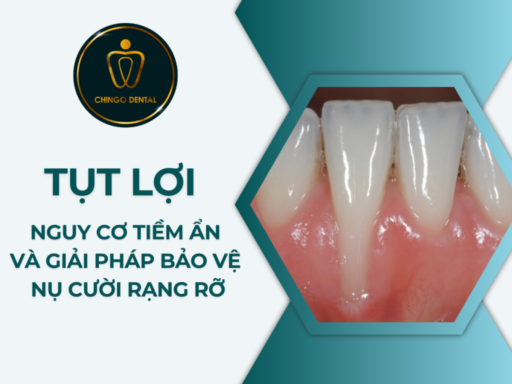 TUT LOI NGUY CO TIEM AN VA GIAI PHAP BAO VE NU CUOI RANG RO