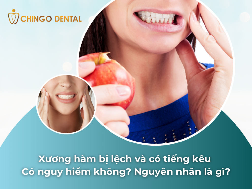 Xương hàm bị lệch và có tiếng kêu có nguy hiểm không? Nguyên nhân là gì? 26 Xuong ham bi lech va co tieng keu co nguy hiem khong Nguyen nhan la gi