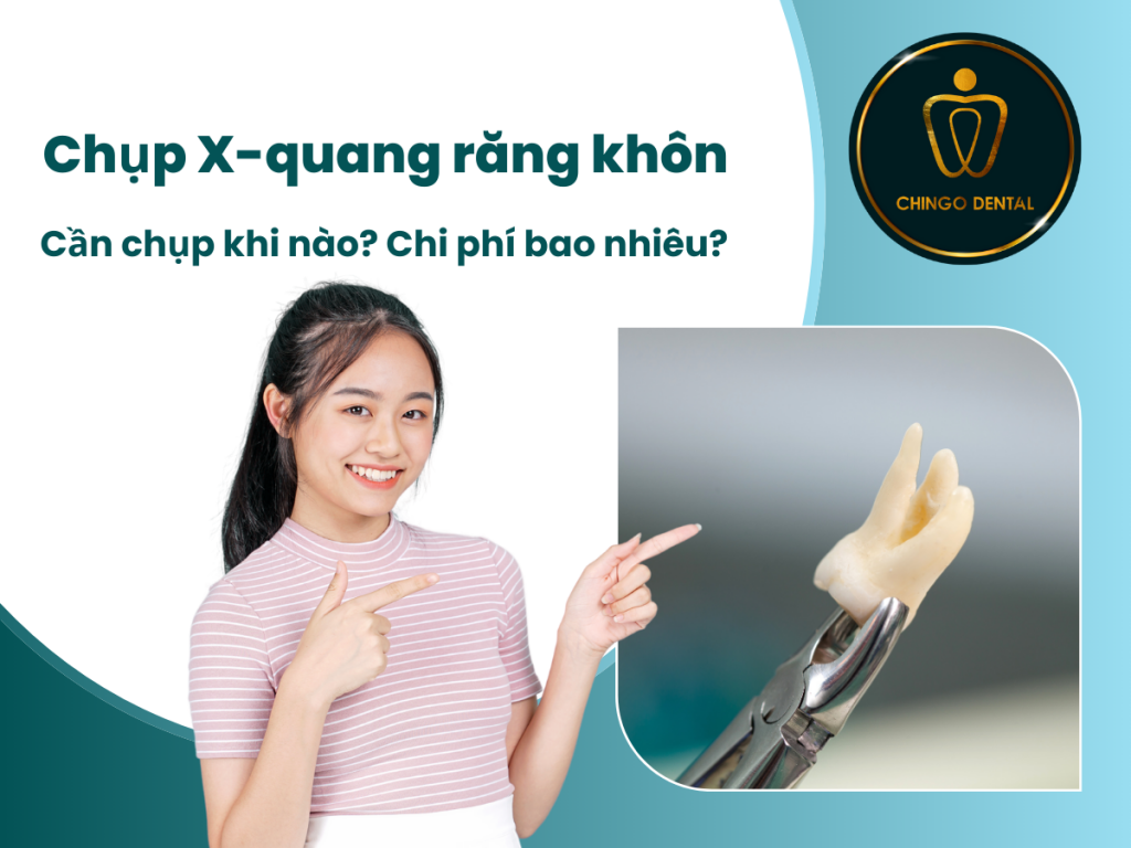 Chụp X-quang răng khôn: Cần chụp khi nào? Chi phí bao nhiêu? 29 1 8