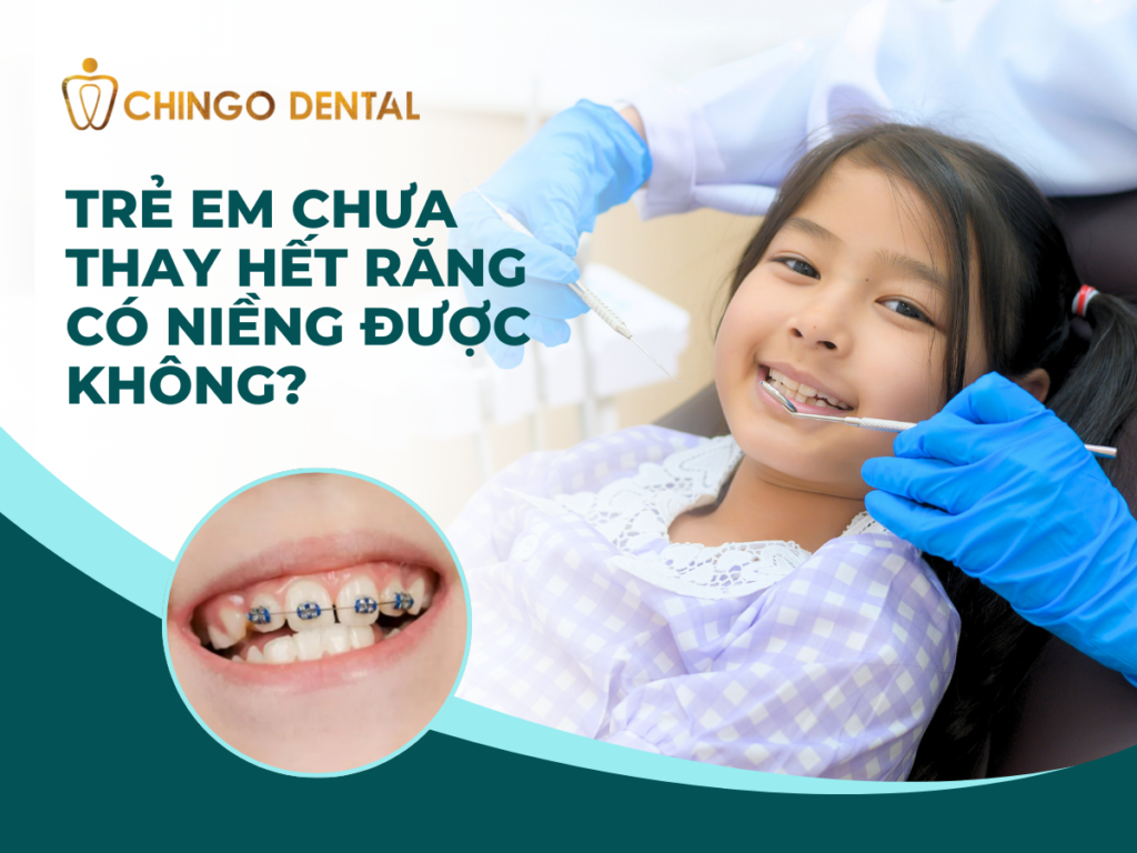 Trẻ em chưa thay hết răng có niềng được không? 17 1 1