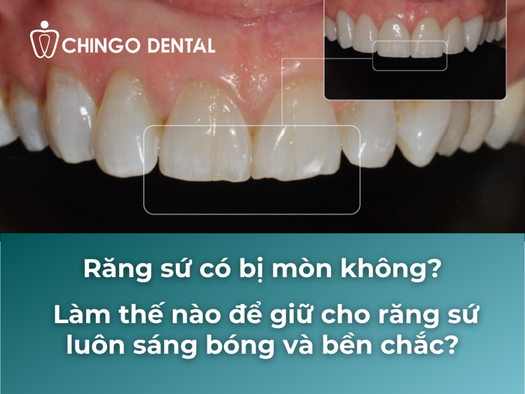 Răng sứ có bị mòn không? Làm thế nào để giữ cho răng sứ luôn sáng bóng và bền chắc? 4 1 3