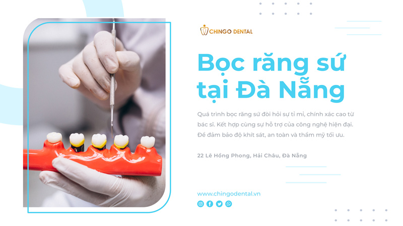 bọc răng sứ tại đà nẵng