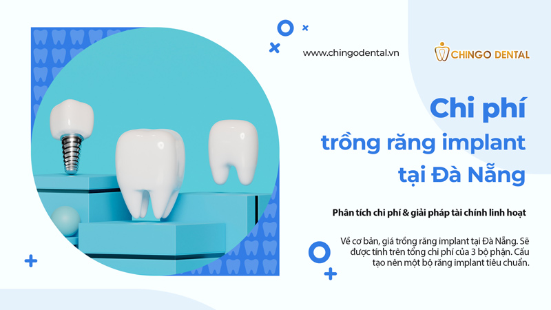 giá trồng răng tại đà nẵng