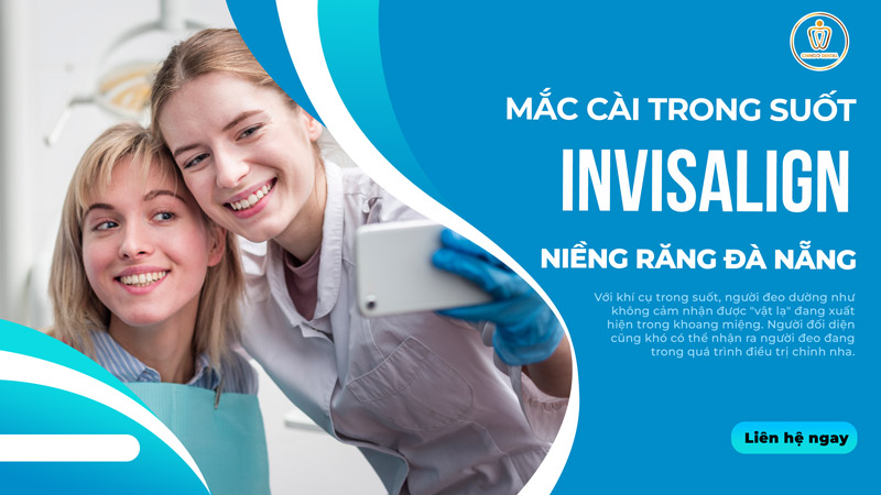 mắc cài trong suốt