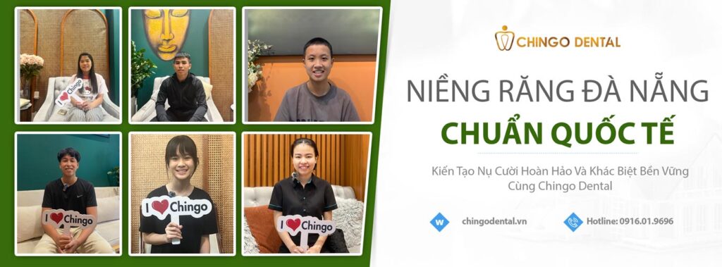 niềng răng đà nẵng