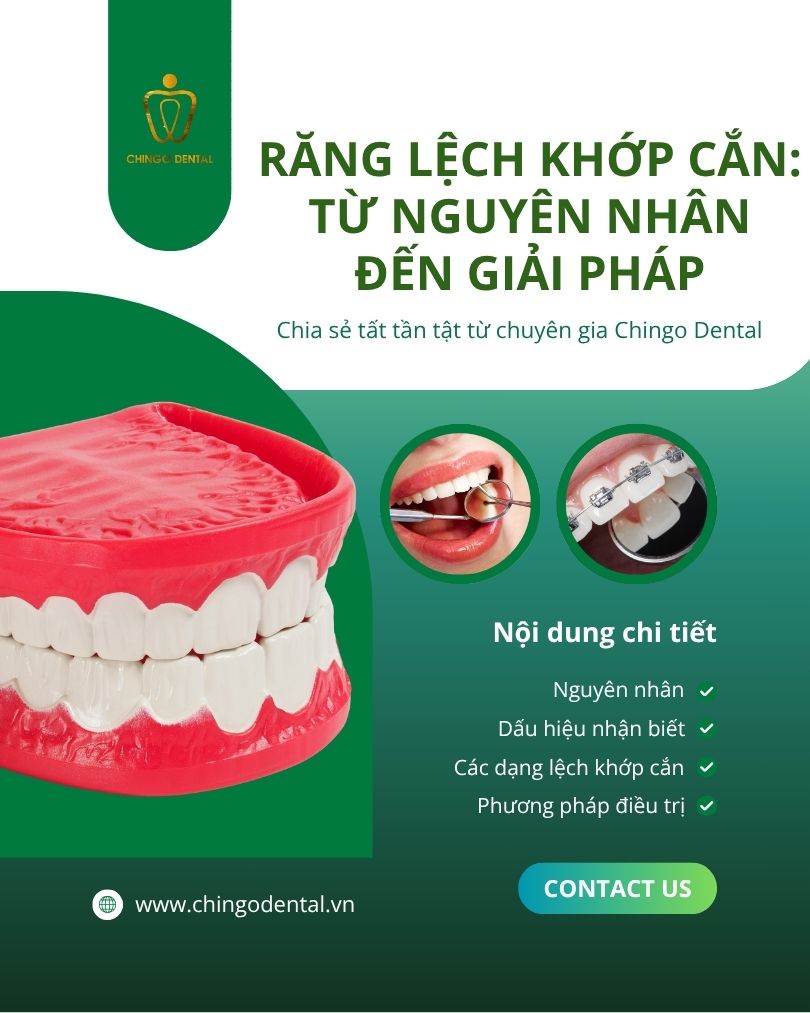 răng lệch khớp cắn là gì