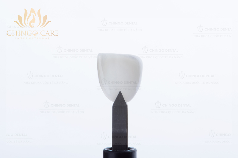 răng sứ veneer
