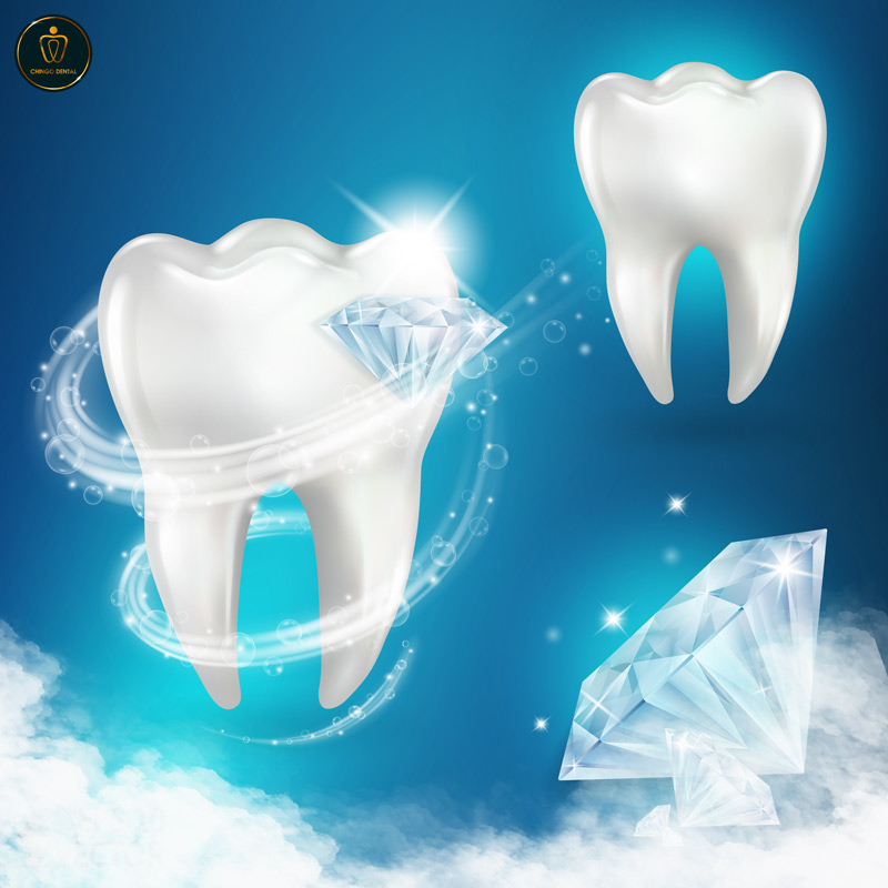 gắn đá lên răng bao nhiêu tiền