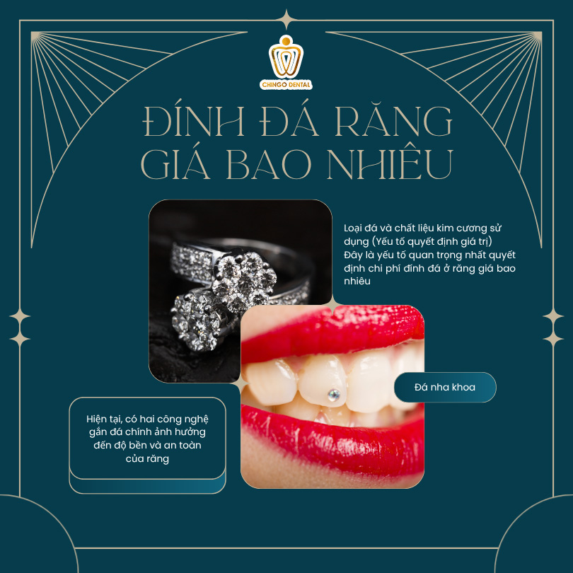 đính đá răng giá bao nhiêu