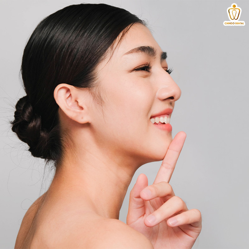 tướng cằm lẹm