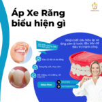 Áp Xe Răng: Nguyên Nhân, Dấu Hiệu, và Phương Pháp Điều Trị Toàn Diện áp xe răng có tự khỏi không