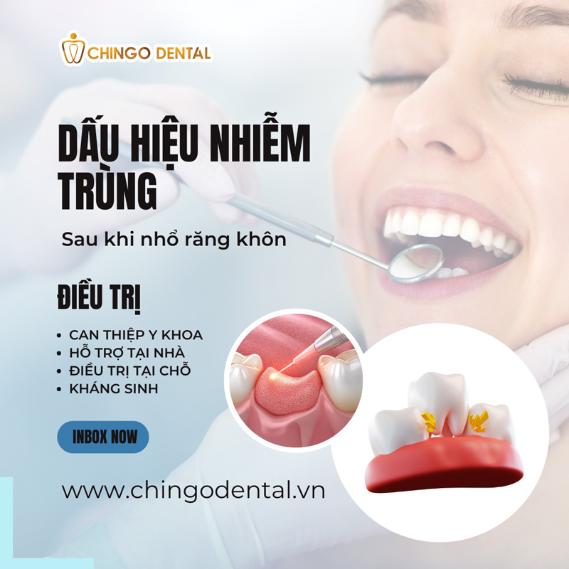 Dấu Hiệu Nhiễm Trùng Sau Khi Nhổ Răng Khôn: 14 Cảnh Báo Nguy Hiểm & Giải Pháp Cấp Tốc 57 dấu hiệu nhiễm trùng sau khi nhổ răng khôn
