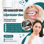viêm quanh chóp răng mạn tính