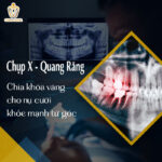 chụp x-quang răng