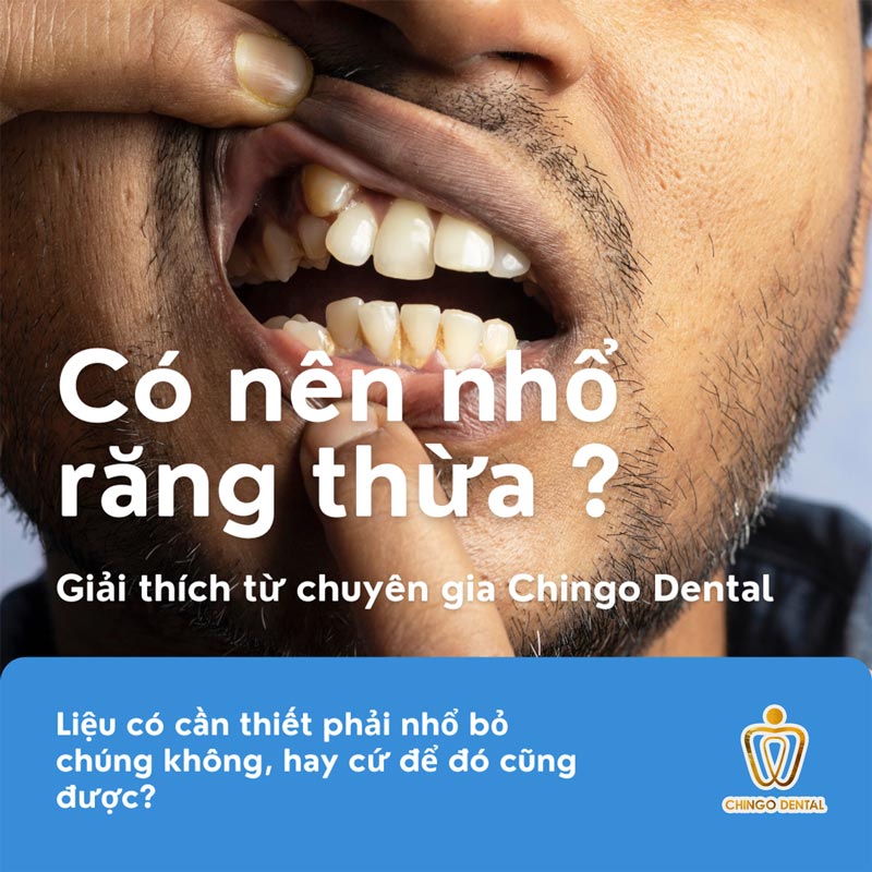 Răng Thừa Có Nên Nhổ? 7 Biến Chứng Ngầm Khiến Bạn Không Thể Chần Chừ 22 hình ảnh răng mọc thừa