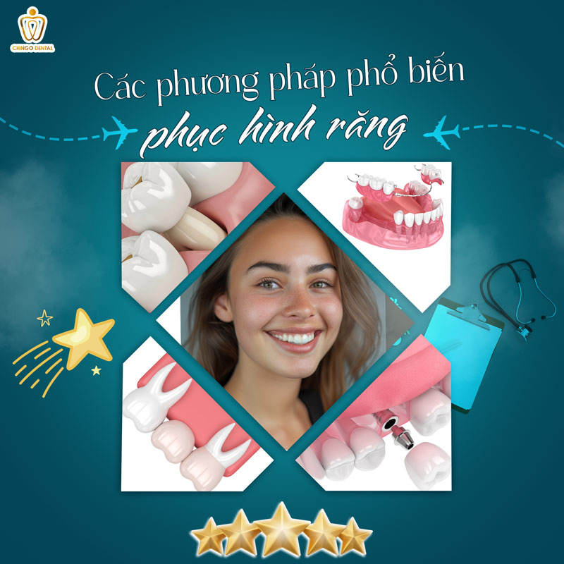 kỹ thuật phục hình răng