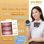 quy trình niềng răng invisalign