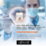 sâu răng mức độ nhẹ