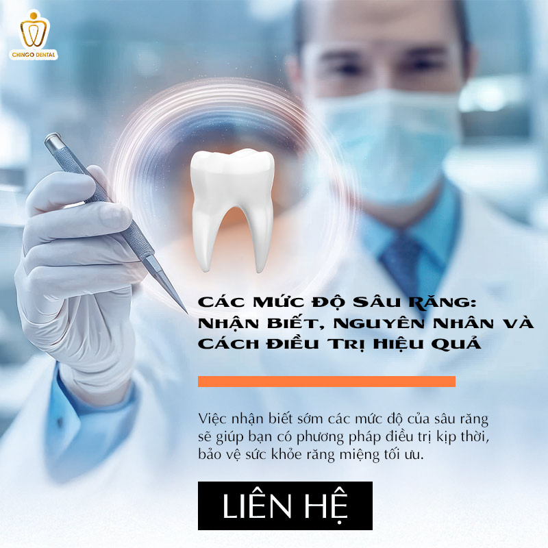 Các Mức Độ Sâu Răng: Nhận Biết, Nguyên Nhân và Cách Điều Trị Hiệu Quả 8 sâu răng mức độ nhẹ