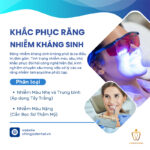 Nguyên nhân răng nhiễm màu kháng sinh là gì?