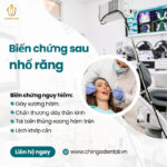biến chứng sau khi nhổ răng khôn hàm dưới