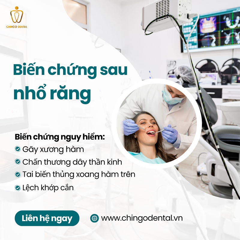 biến chứng sau khi nhổ răng khôn hàm dưới