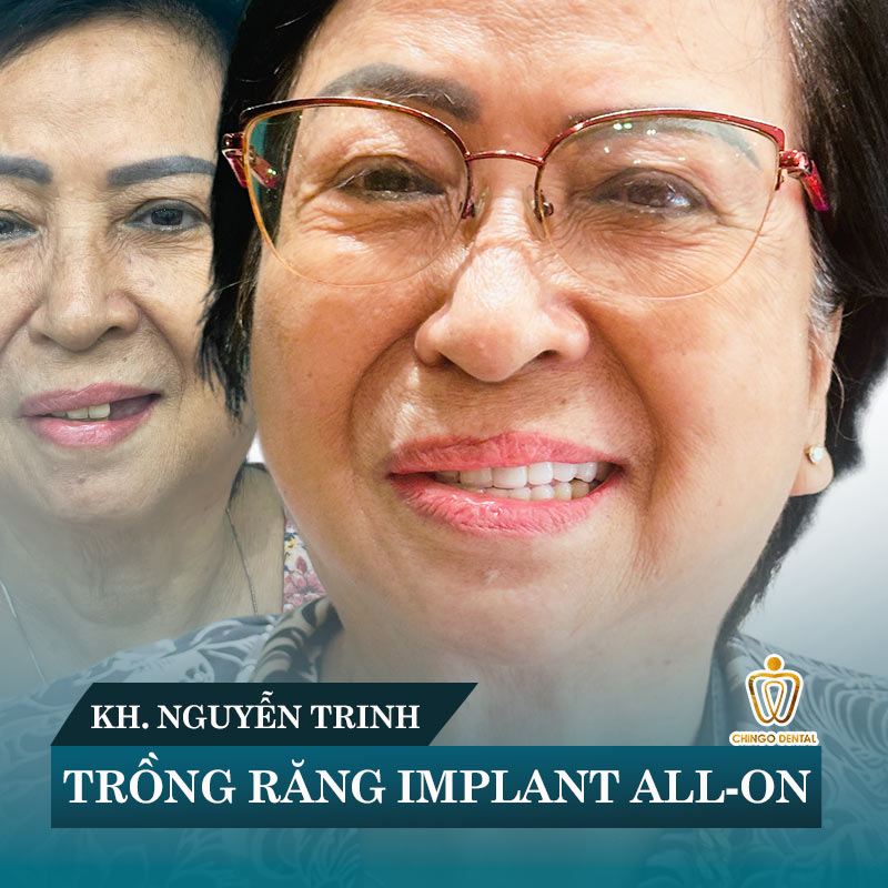 giá nhổ răng hàm bị sâu