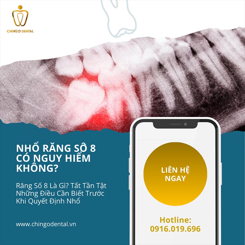 những biến chứng sau khi nhổ răng số 8
