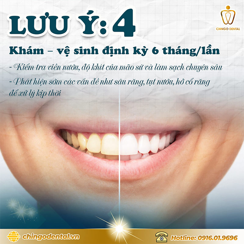 cach tri rang bi o vang tai nha