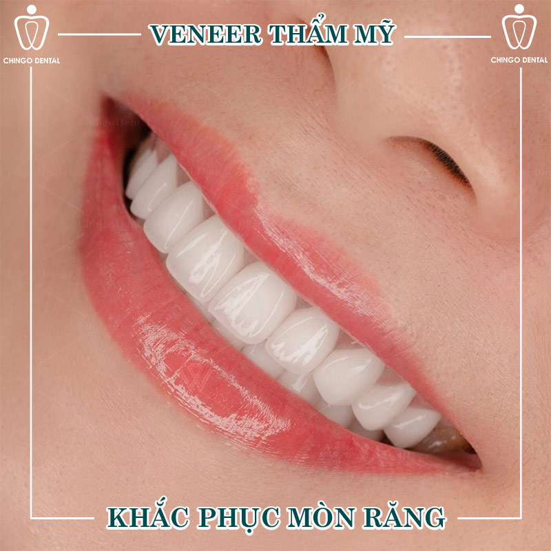 cách xử lý khi răng sữa của trẻ bị mòn