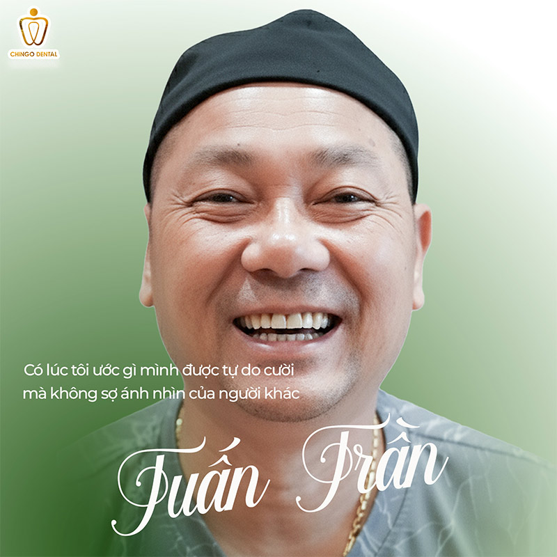 răng bị đổi màu