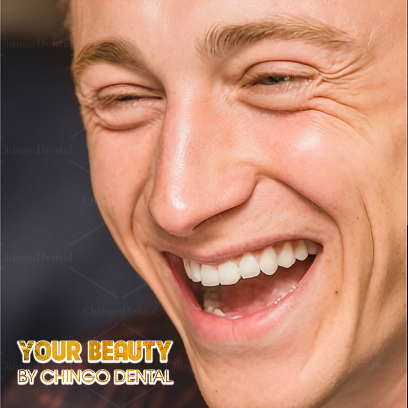 răng có vệt đen