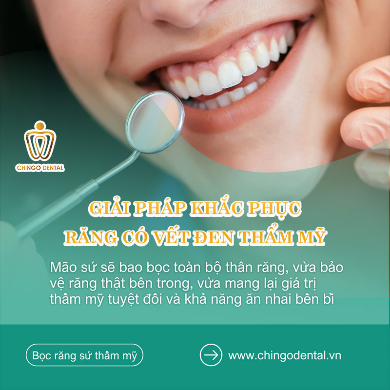 tại sao răng có vết đen